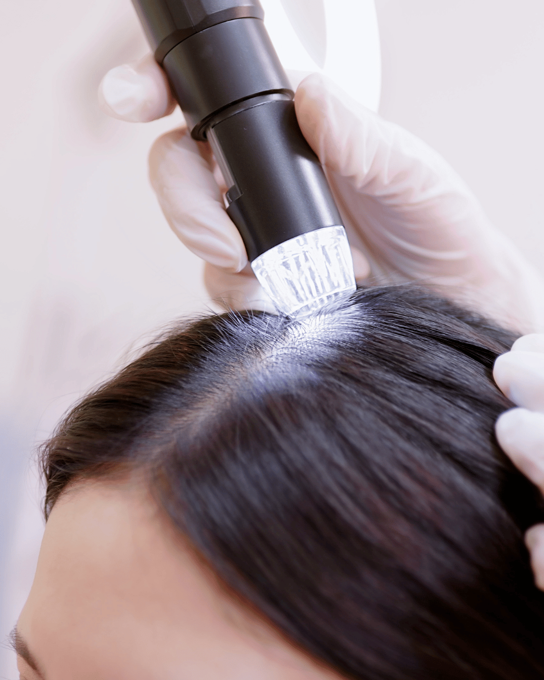 GFC Hair Treatment