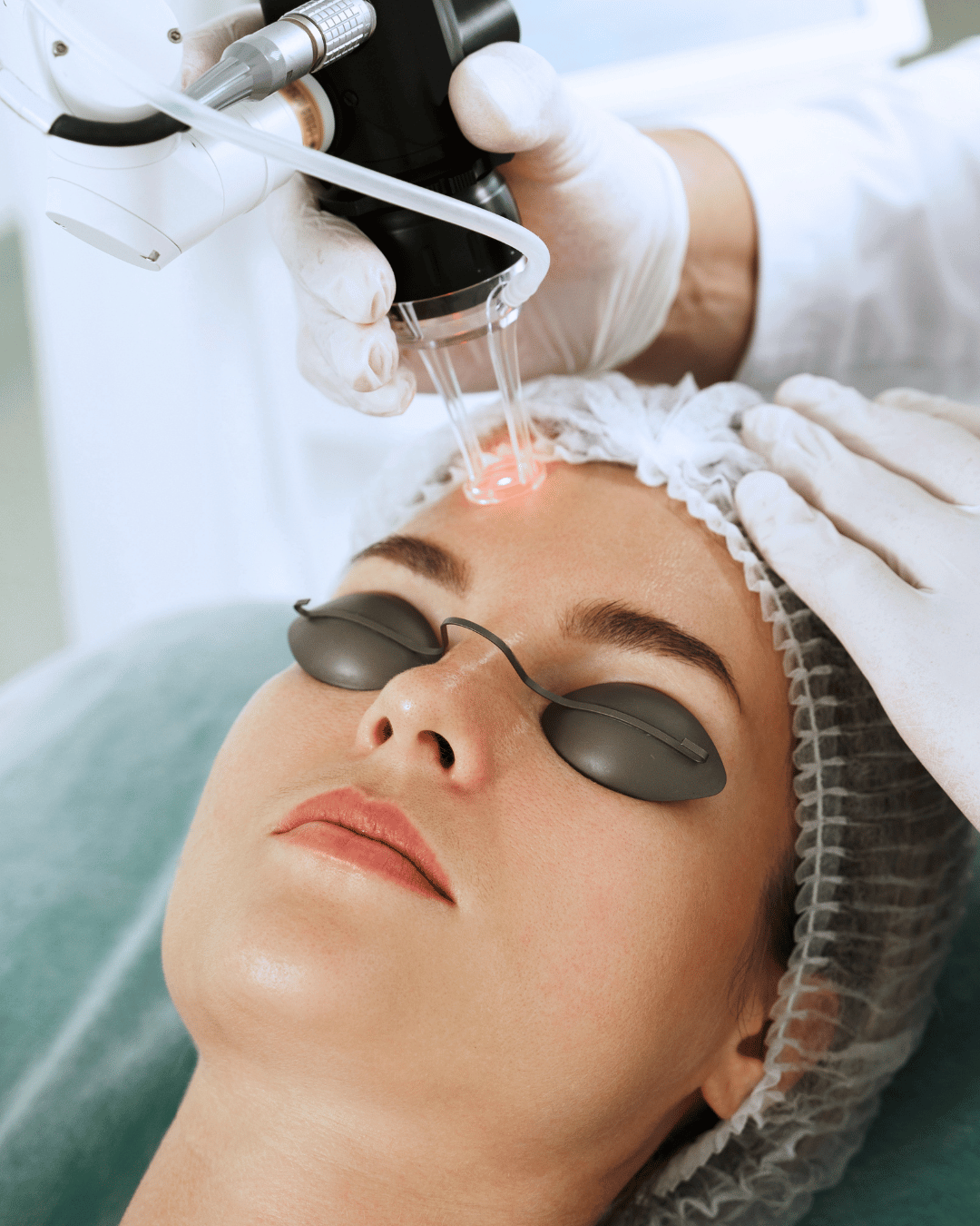 Pigmentation Treatment
